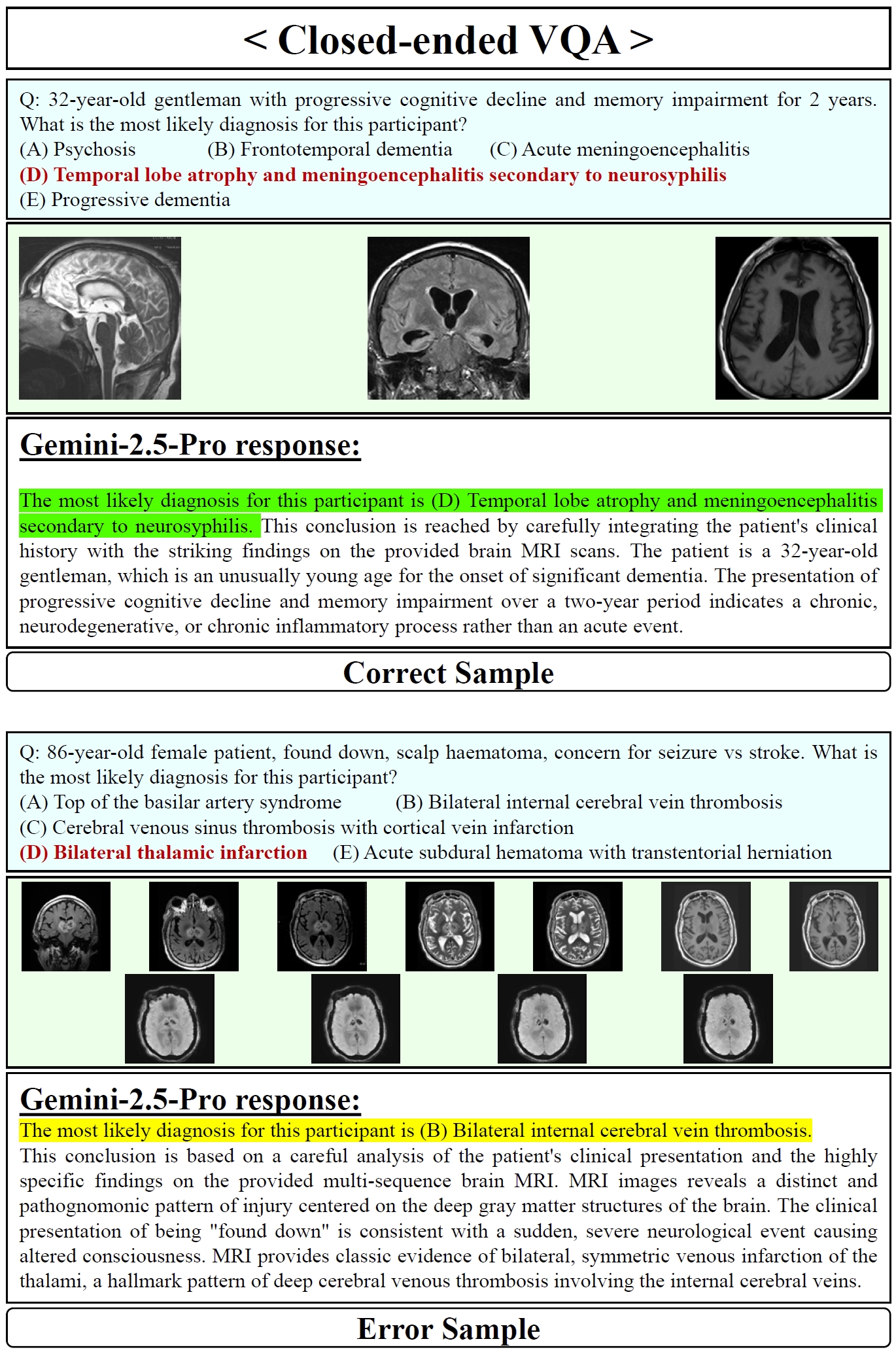 Gemini-2.5-Pro Closed-ended VQA Samples